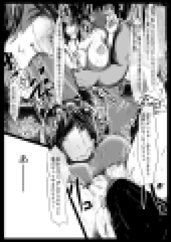 俺のヒロインが全員NTR3